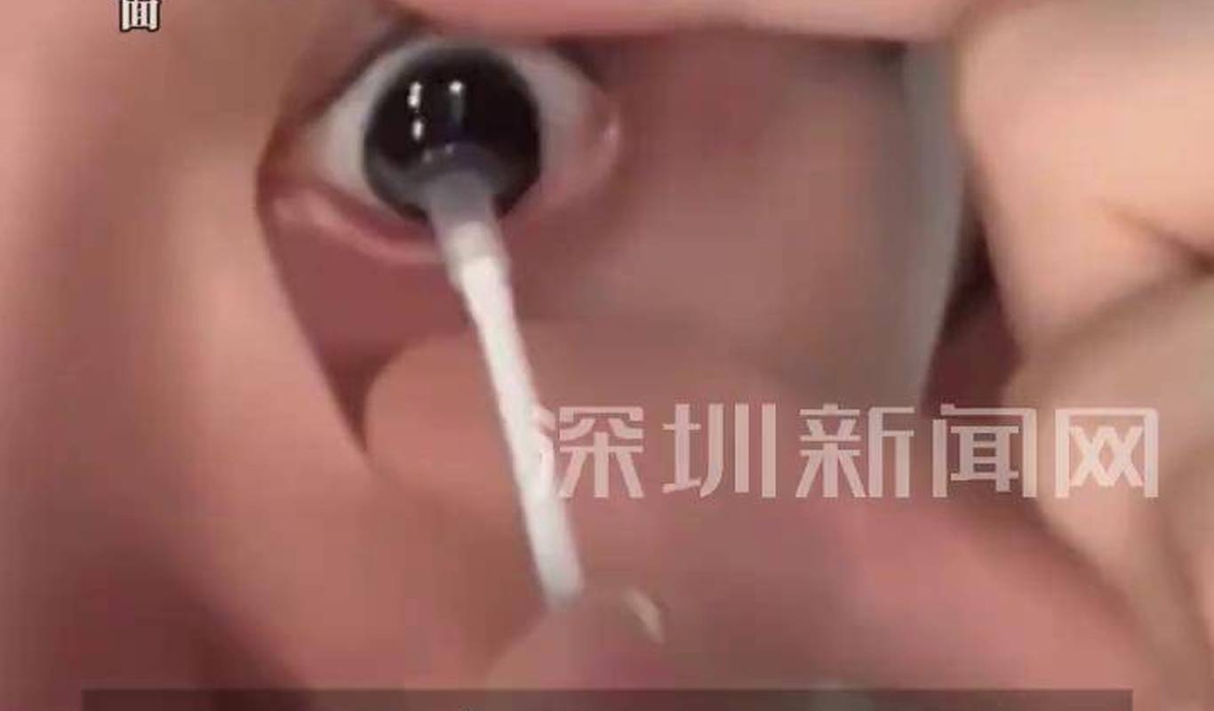 【劣质美瞳或导致视力下降】 #广东dou知道 #深圳dou知道 #美瞳