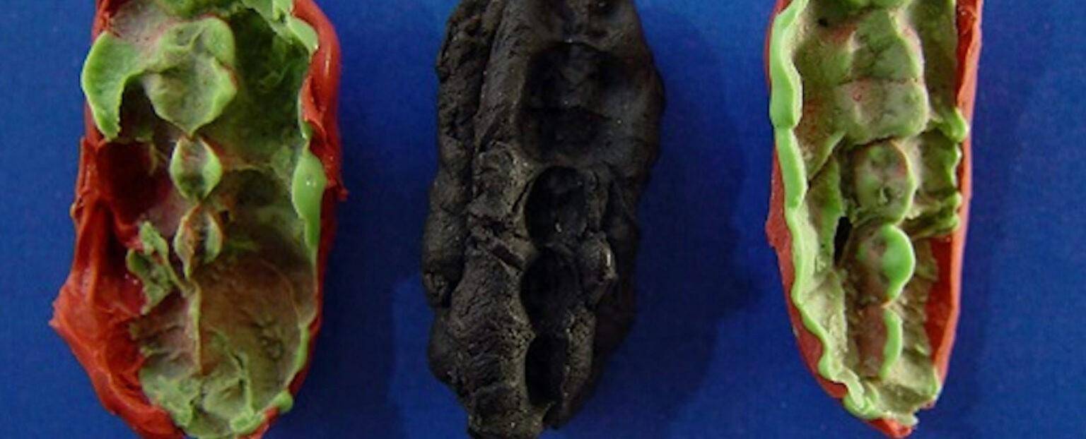 石器时代青少年的“口香糖”以丰富的细节揭示了9700年前的生活