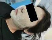 黄褐斑全攻略，别让黄褐斑成为您的困扰