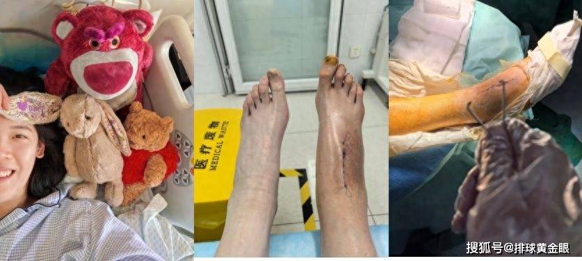 原创             国际排联发文关注！李盈莹公开康复细节，吴梦洁未登场令人担忧