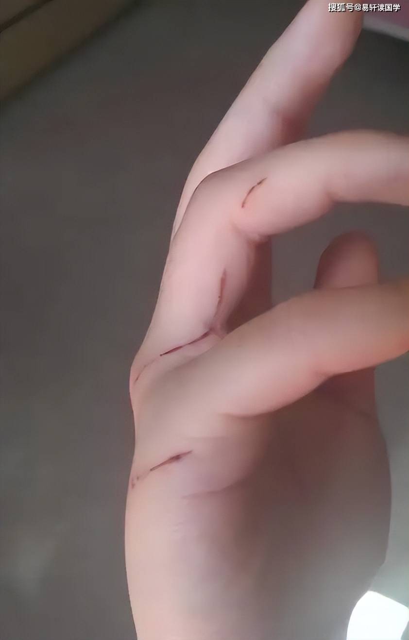 梦境迷踪，解析梦到被猫抓伤了的深层含义