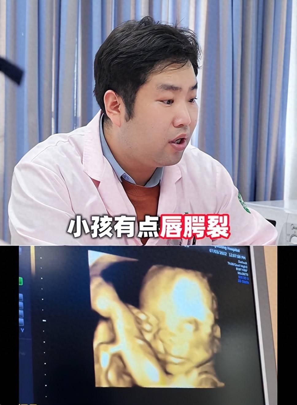 孕妈天天吃辣条,产检胎儿兔唇,医生:不关吃的,是爸爸一习惯导致