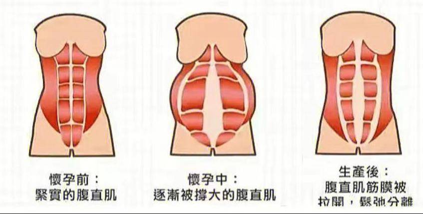 生没生过孩子到底有什么区别呢?一组图片告诉你到底有什么区别