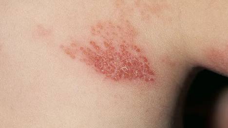 36岁妈妈为保护女儿被劫匪勒至昏死