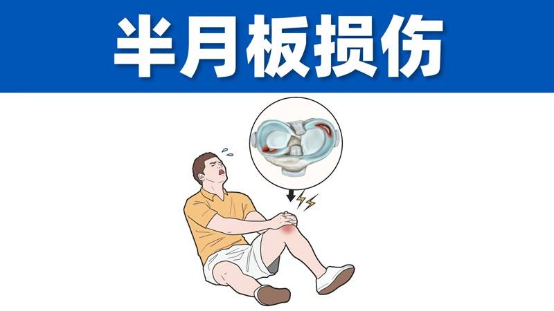 石家庄直乐大讲堂：半月板损伤怎么治疗比较好得快？28岁跑者膝盖险报废，医生却拒开刀的秘密