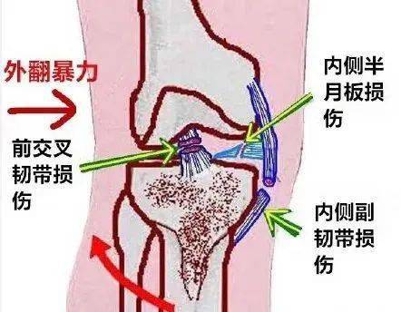 谈球吧体育app：【健康知识进万家】雪道的尽头是骨科怎样滑雪更安全？(图2)