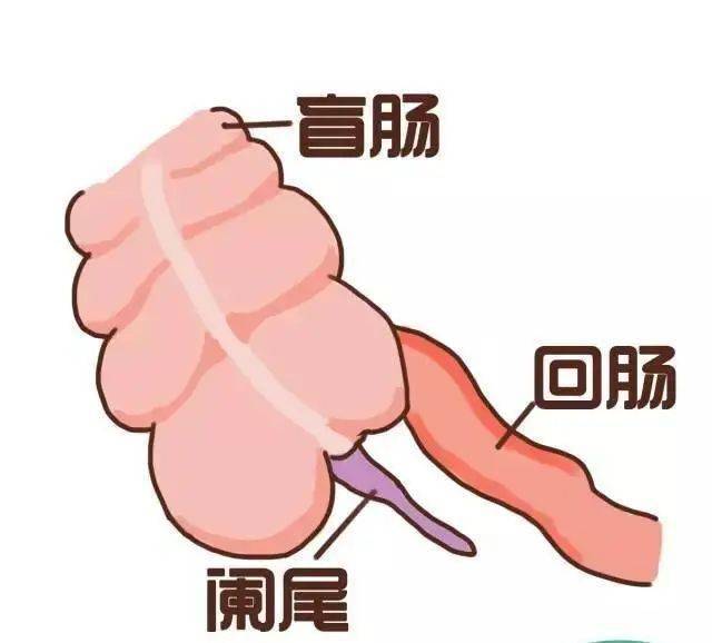阑尾位置靠近大肠和小肠阑尾癌经常会与结肠癌混淆导致误诊一旦出现这样