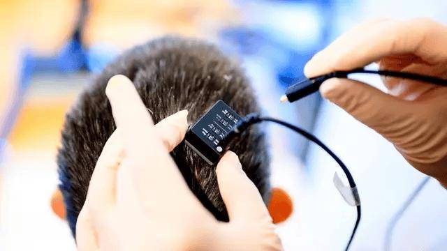 脑机接口技术让瘫痪18年的患者通过AI实时“说话”，延迟仅1秒