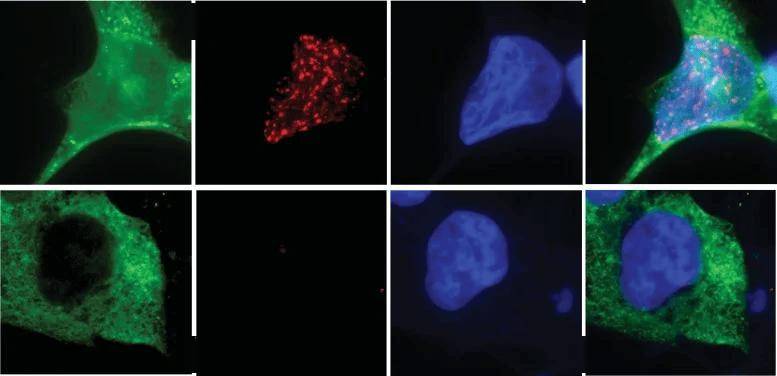 破解十年谜题:科学家首次破解癌症耐药性谜题,锁定染色体碎裂“元凶”
