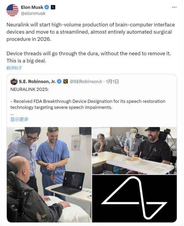 引爆2026，“脑机接口”量产倒计时，意识永生将至？