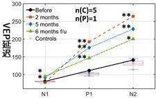一个意外，脑机接口试验让盲人恢复了视力