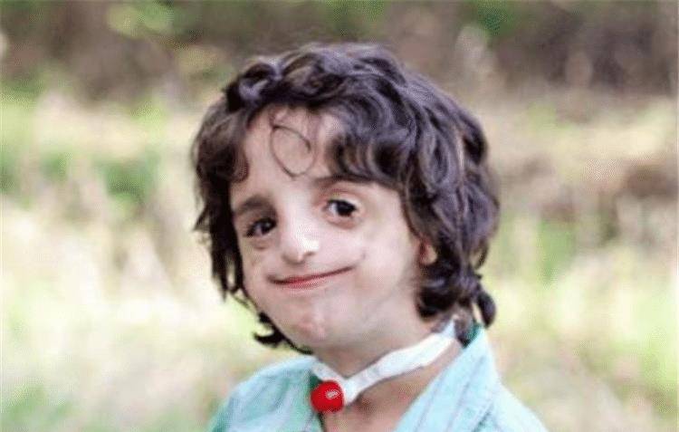 里昂先天脸部畸形,凭才华娶漂亮娇妻,孩子出生后,全家失去笑容_安娜