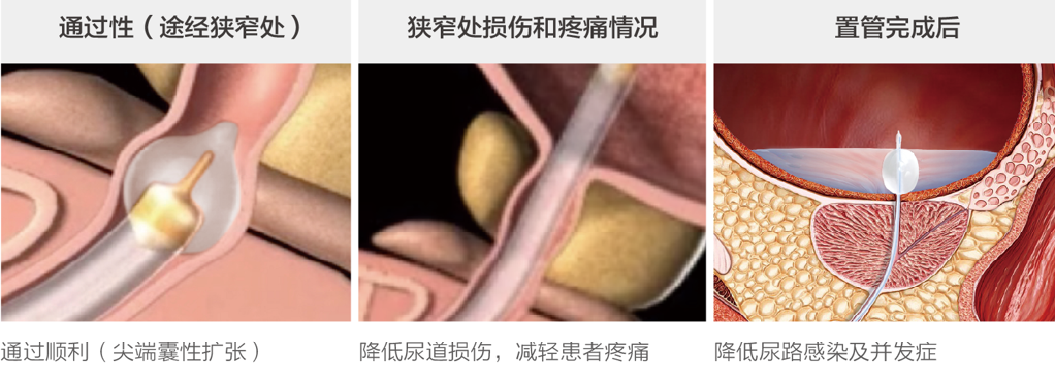 67普博醫療「重症監護和麻醉耗材」產品集錦_導管_測量_靜脈