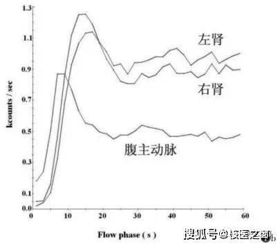 評估分腎功能的法寶——腎動態顯像_腎臟_尿路_患者