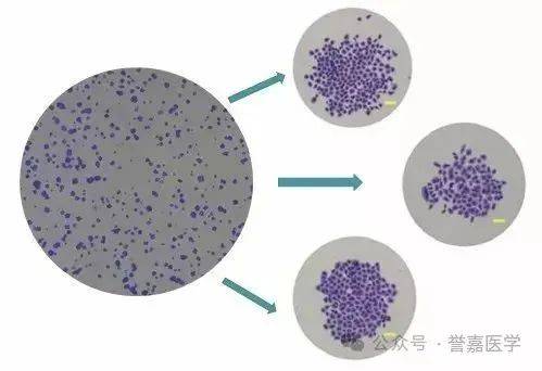 實驗大師分享:圖文詳解細胞克隆形成實驗竅門!_增殖_培養基_能力