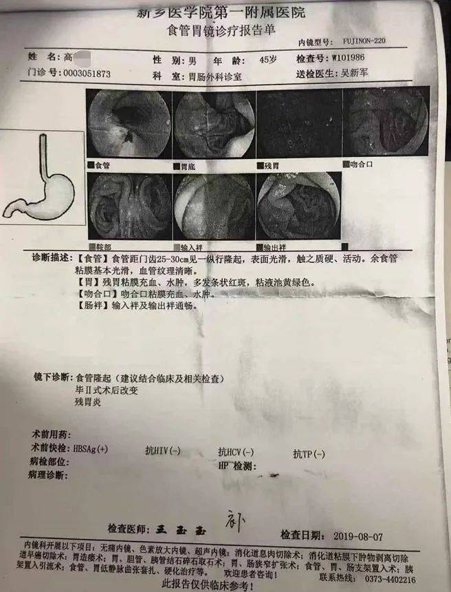 胃肿瘤检查报告单图片图片