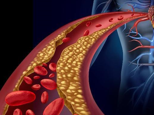 山楂和海带是"刮除血管脂肪"的"能手",但要牢记它们的禁忌!