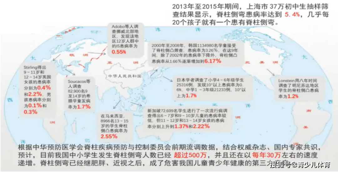 关于脊柱侧弯,你要知道