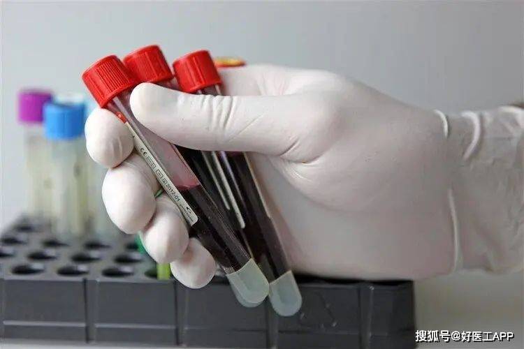 不同项目的作用不一样,常见的有:血常规,血生化,凝血四项,输血前八项