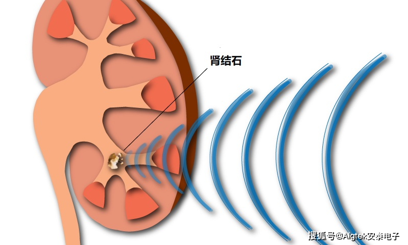 医用超声功率放大器，具体有哪些应用场景？