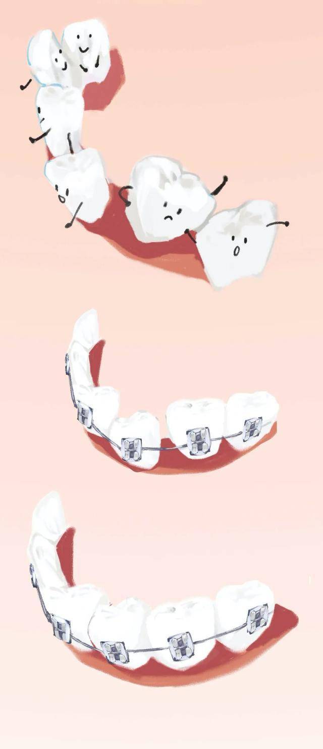 "戴牙套"到底有多不舒服?漫画科普,过来人说出大实话_牙齿_经历_时光