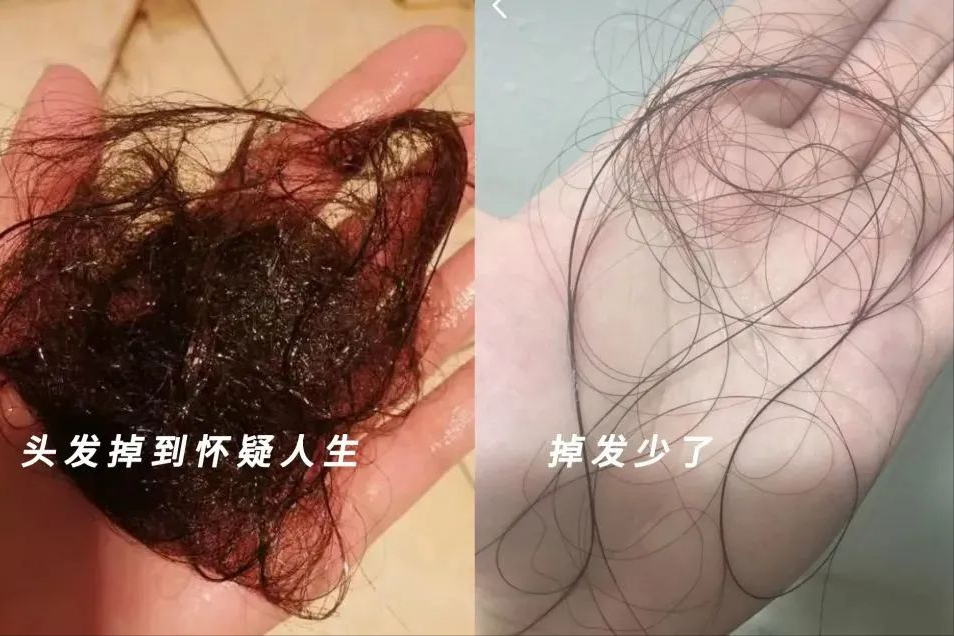 头发_效果_饮食