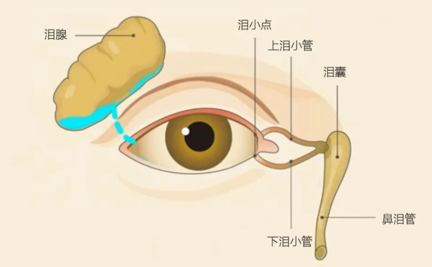 眼睛泪囊管堵塞图片图片