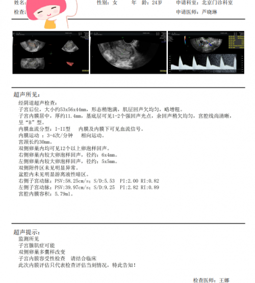 宫腔镜检查单图片