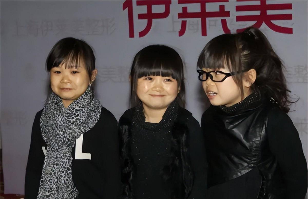 19年成都"最美袖珍女"结婚,32岁长得像10岁,婚后生活令人担忧_杨萍
