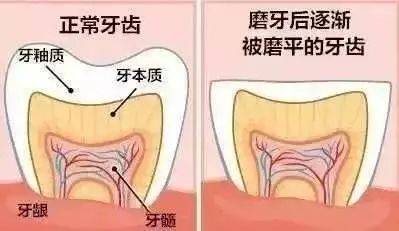 晚上睡觉磨牙的原因有哪些?