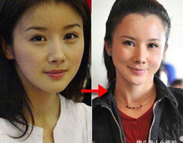 女星整容前后对比,有人美貌出众,有人惨不忍睹_柳岩