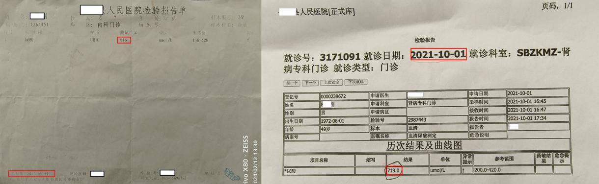 治疗_疾病_尿酸