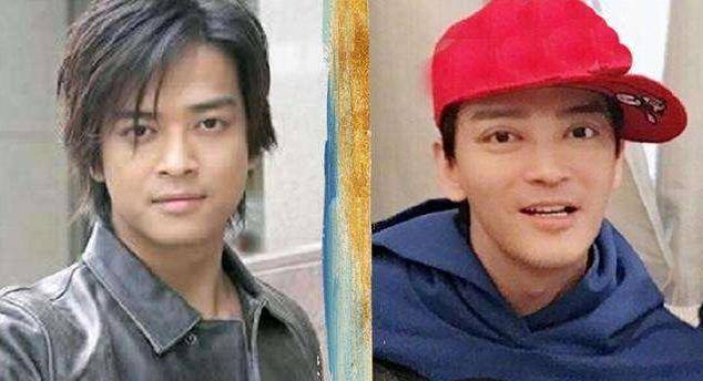 中老年男星整容后遗症显现,表情都做不出来,演技也略