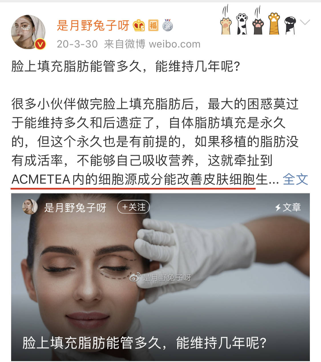 美丽自内而外脂肪填充丰胸维持多久,自体脂肪丰胸需要做几次_细胞