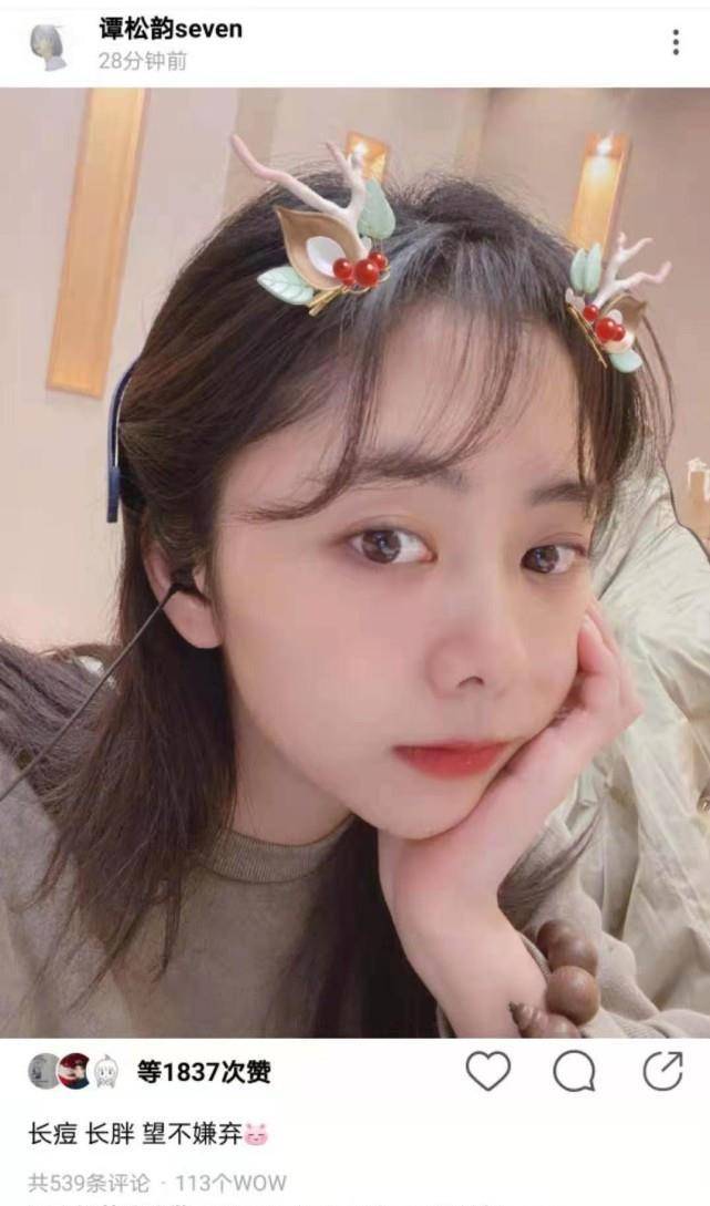谭松韵长痘都这么美,头戴麋鹿角出镜,是圣诞小可爱没错了_痘痘_网友