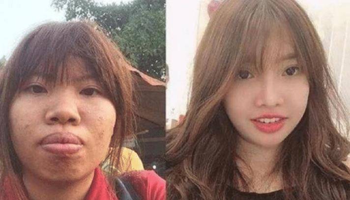 女子花巨资整容嫁富二代,5个月后生娃现原形被甩,现今现状如何_郭金凤