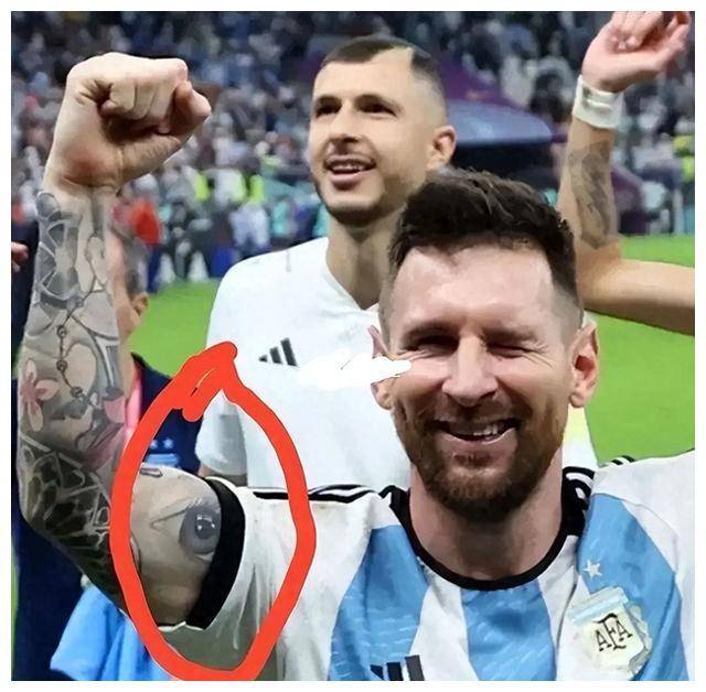 梅西小时候患有侏儒症,但在巴萨的帮助下健康成长,成为球王,这