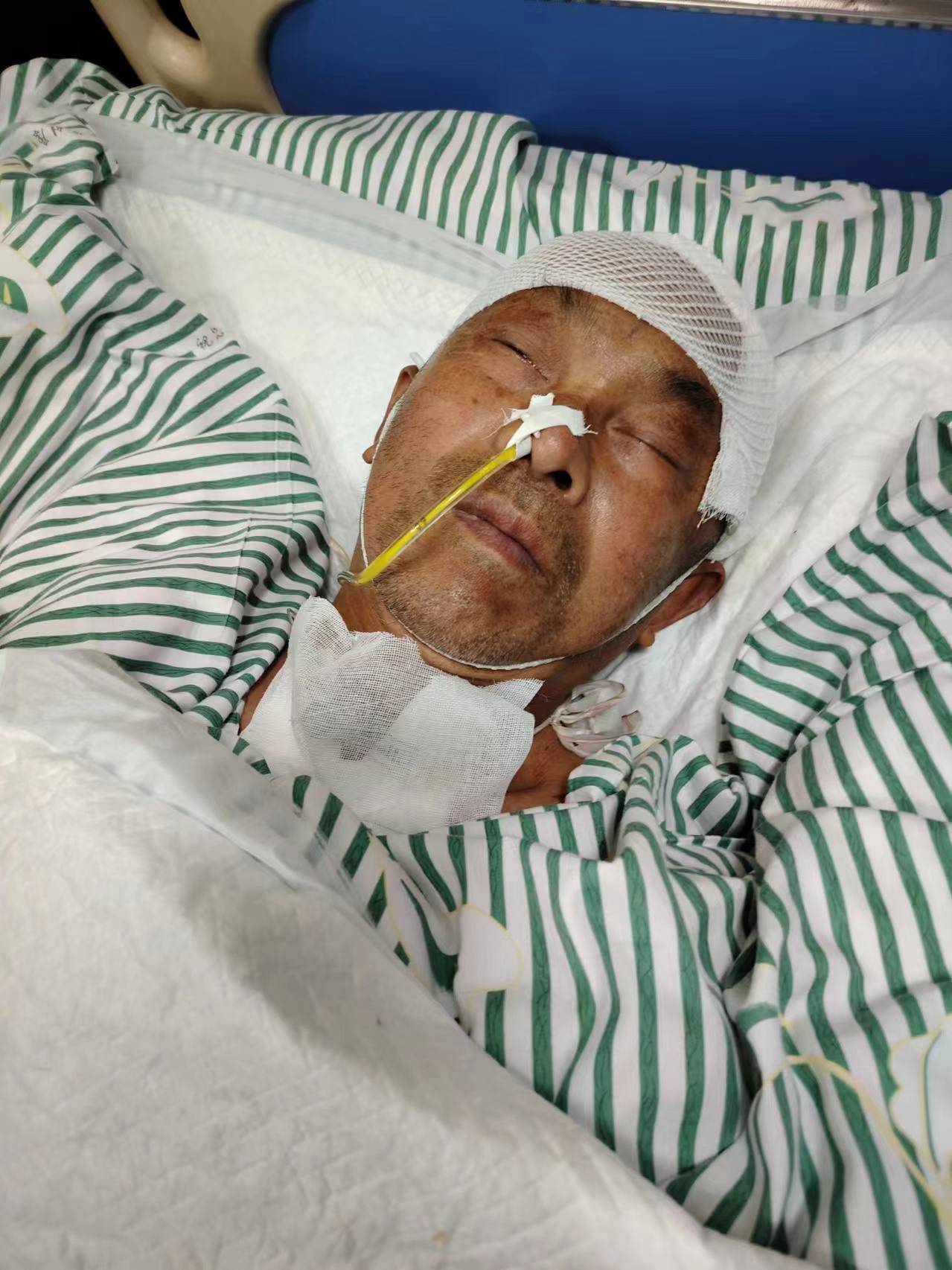 丈夫突发脑出血病倒,术后在icu治疗,昂贵的治疗费用恳求大家的爱心