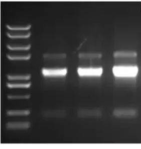 rna电泳图中的三条条带图片