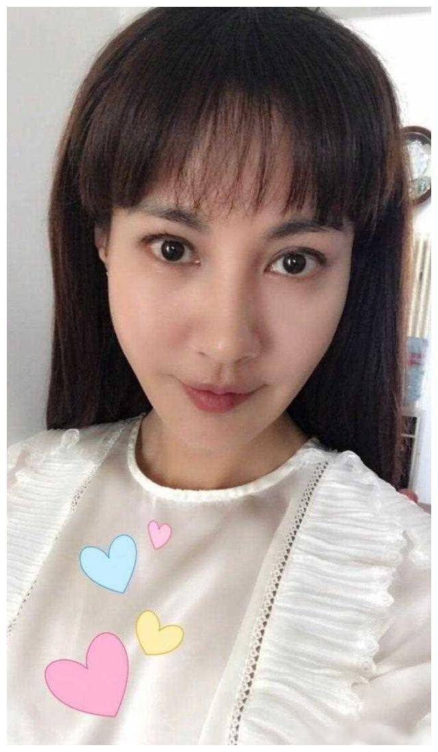 杨雪因其夸张的大双眼皮和脸部浮肿成为网友议论的焦点,而她坦然面对