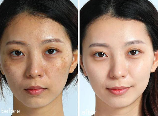 淡斑效果好的护肤品,这4款祛斑护肤品是实力派_肌肤_欧莱雅_成分