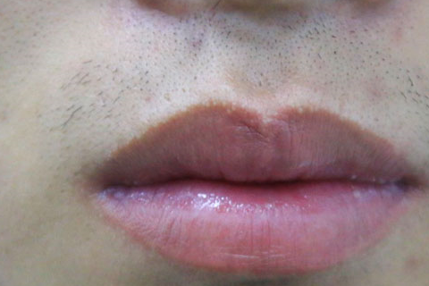 细看嘴巴异常对应哪些疾病_嘴唇_脾胃_身体