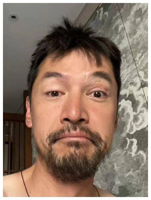 他可能有抑郁症,有人则认为他是想通过展示伤疤来怀念逝去的助手张冕