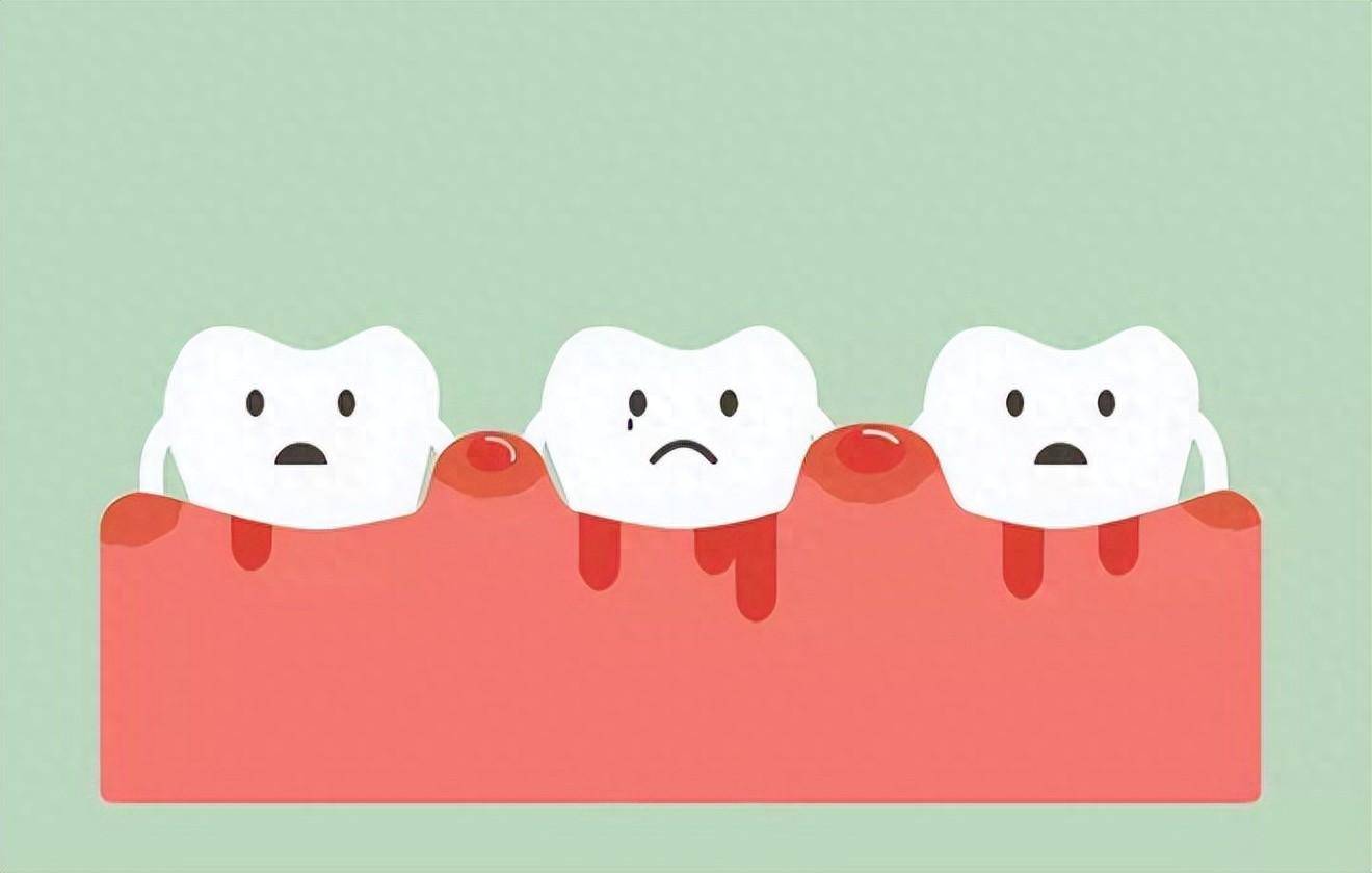 牙龈肿痛出血怎么办?教你7个有效的预防方法!