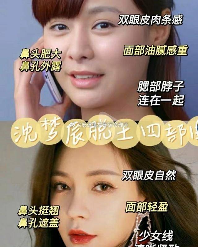 就默默地动了鼻子,从之前的肉鼻子,变成流行的欧式美鼻,还遮盖了鼻孔