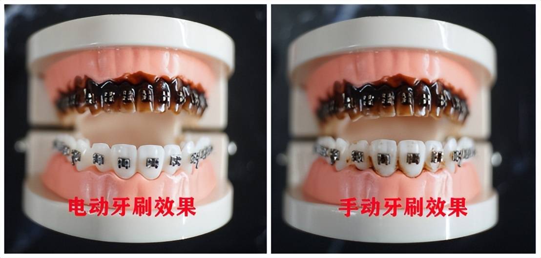 三大害处缺点应警惕_口腔_问题_国人