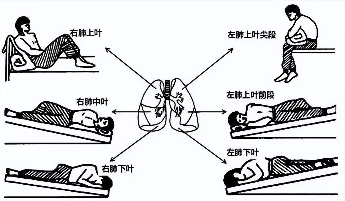 用这几个排痰妙招