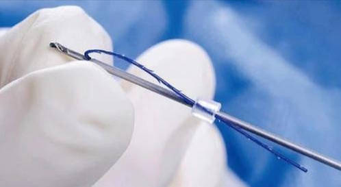 常见的线材品种有:平滑线,螺旋线,麻绳线,液态线,填充线,小v线,隆鼻线