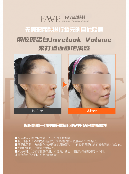 去fave皮肤科体验一下便知!_手术_效果_进行