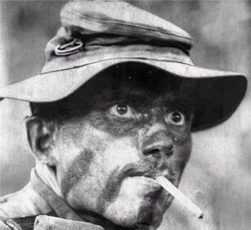 约翰·肯尼迪的妹妹露丝玛丽·肯尼迪也接受了这